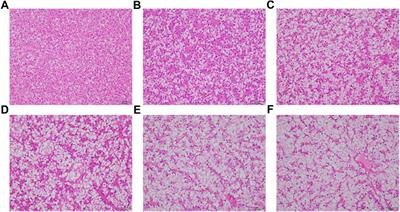 Replacement of dietary fish meal with Clostridium autoethanogenum meal on growth performance, intestinal amino acids transporters, protein metabolism and hepatic lipid metabolism of juvenile turbot (Scophthalmus maximus L.)